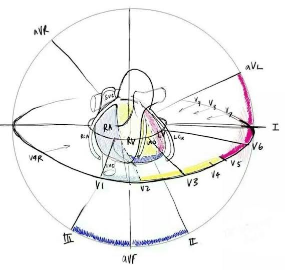 Interpretación Avanzada del ECG